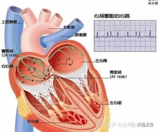 新版心脏起搏器国家标准发布