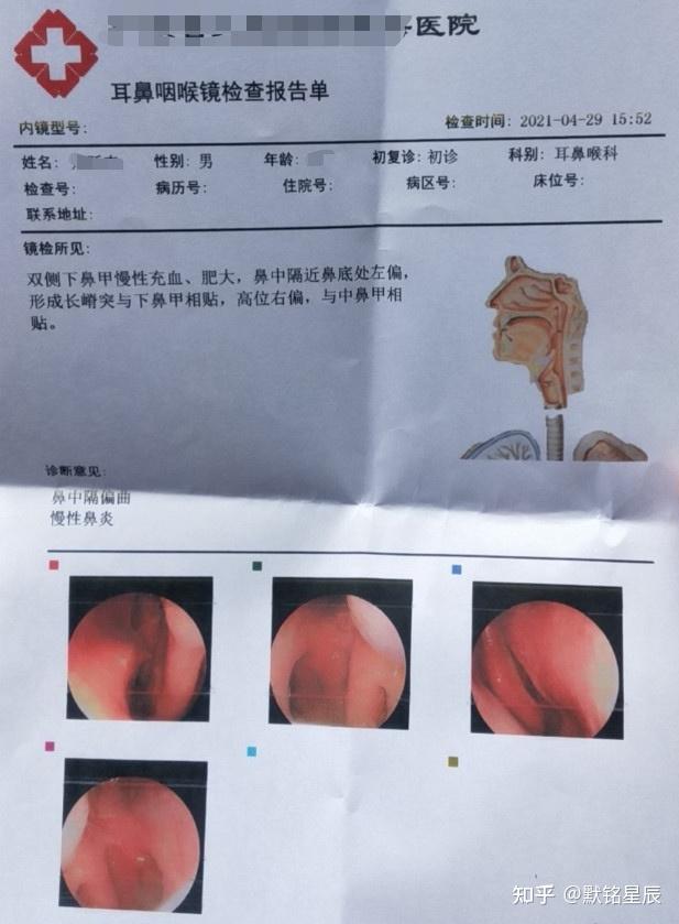 我国团队揭示顽固慢性鼻病 背后“元凶”