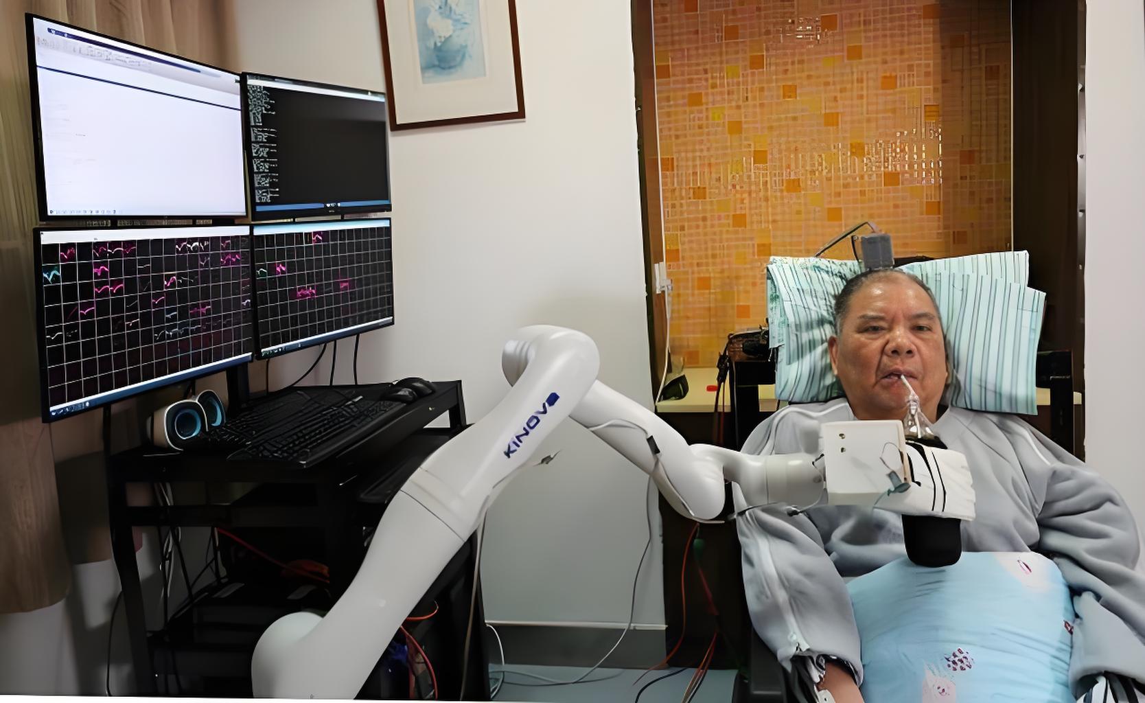 神经接口植入手术让截瘫患者实现自主行走